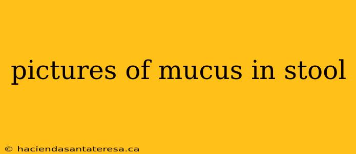 pictures of mucus in stool